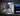 Fractal 75 Pro Max© Lite Kit